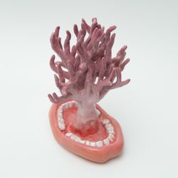 Cladonia