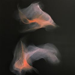 Кои